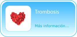 Descubra su ADN y conozca cómo prevenir la trombosis venosa